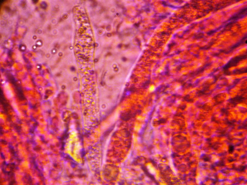 Crosta da determinare (Peniophora incarnata)